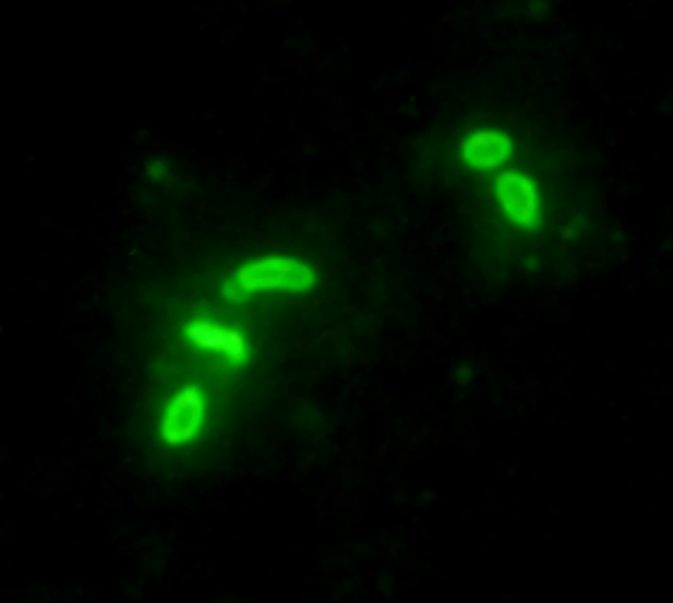 Introducción a la identificación automática