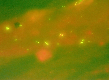 Introducción a la identificación automática