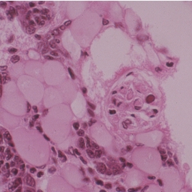 Introducción a la identificación automática